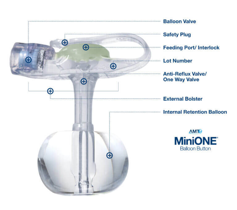 AMT MiniONE Balloon Button Low Profile 16F 1.5cm PEG Feeding Tube, Each